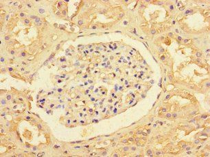 SLC35F6 antibody