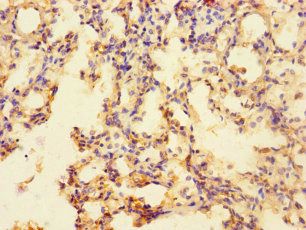 SLC35F6 Antibody