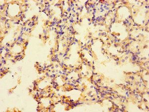 SLC35F6 antibody