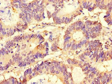 SLC37A1 Antibody