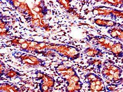 SLC37A2 Antibody