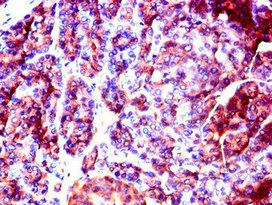 SLC37A2 Antibody