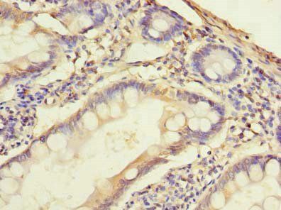 SLC38A2 Antibody