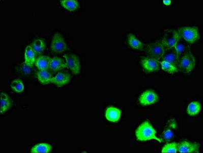 SLC38A6 antibody