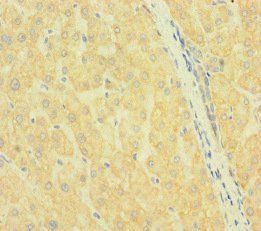 SLC38A9 Antibody