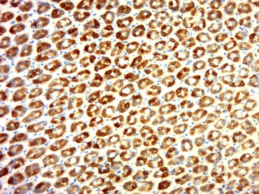 SLC39A4 antibody