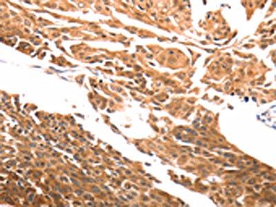 SLC39A6 antibody