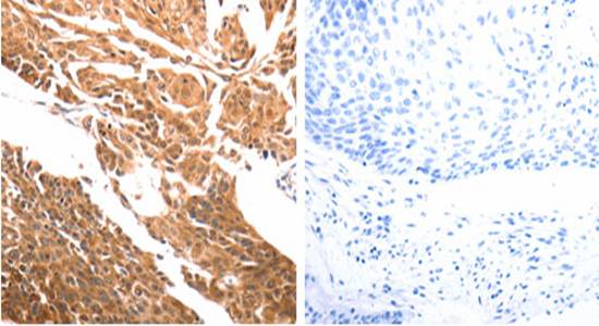 SLC39A6 Antibody