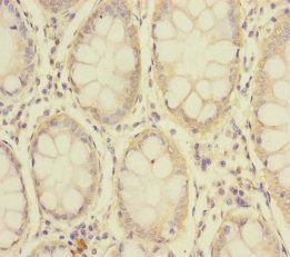 SLC39A7 Antibody