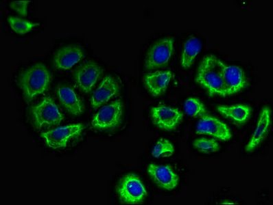SLC3A1 Antibody