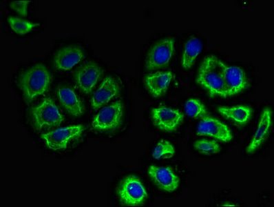 SLC3A1 antibody