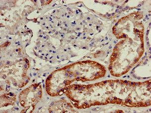 SLC3A1 Antibody