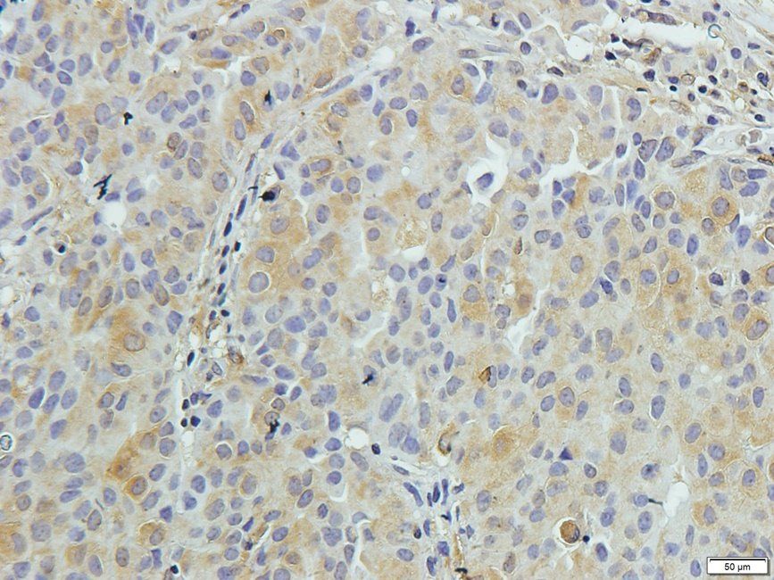 SLC3A2 antibody