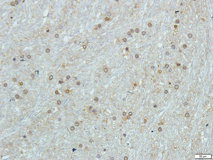 SLC3A2 antibody