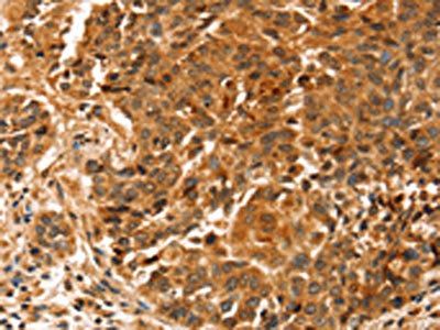SLC41A2 Antibody