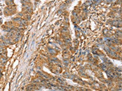 SLC41A2 Antibody