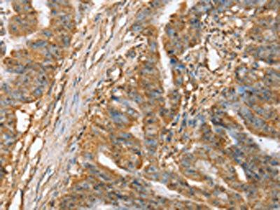 SLC41A2 antibody