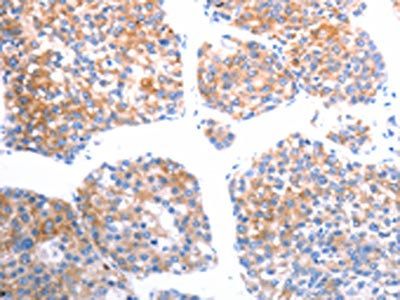 SLC44A1 antibody