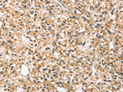 SLC44A2 antibody