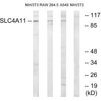 SLC4A11 Antibody