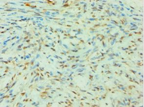 SLC4A2 Antibody