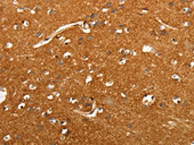SLC4A4 Antibody