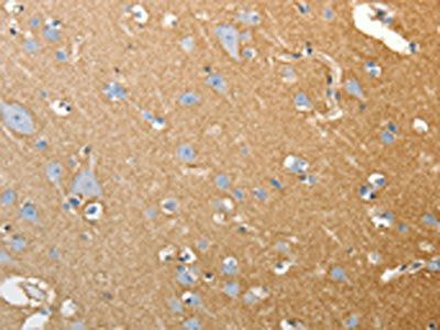 SLC4A4 Antibody