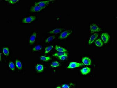 SLC52A1 Antibody