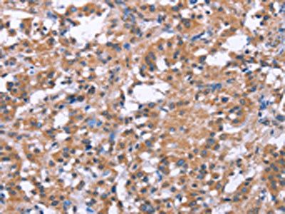 SLC52A1 antibody