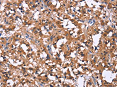 SLC52A1 Antibody