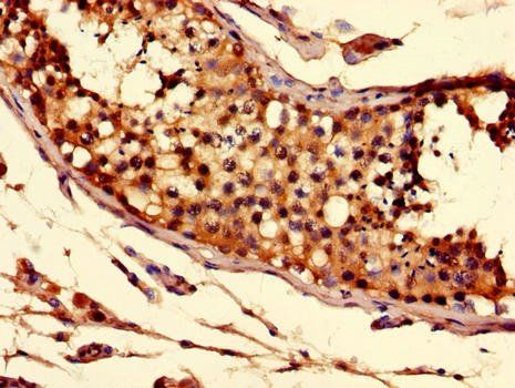 SLC52A3 Antibody