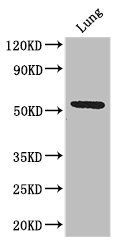 SLC52A3 Antibody