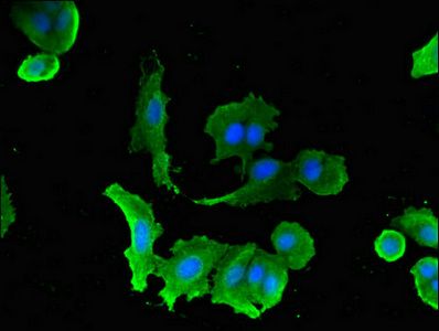 SLC5A1 Antibody