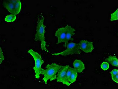 SLC5A1 antibody