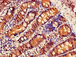 SLC5A1 Antibody