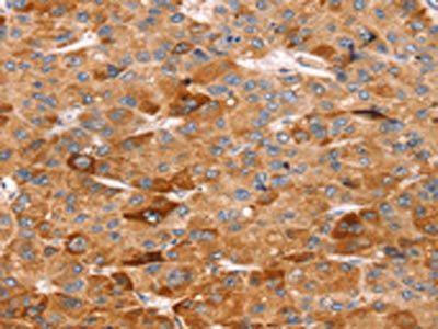 SLC5A11 Antibody