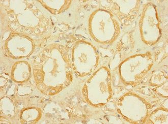 SLC5A2 Antibody