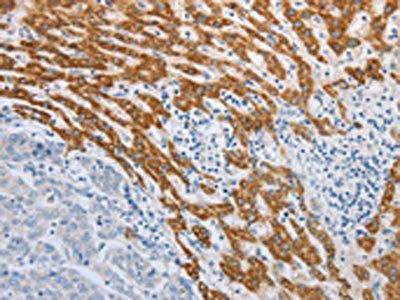 SLC5A5 Antibody