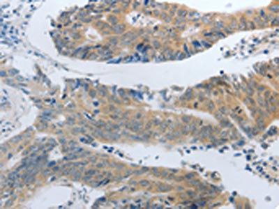 SLC5A5 Antibody