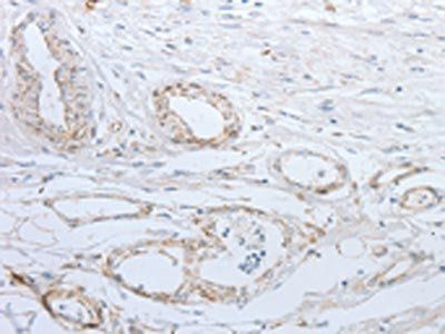 SLC5A5 Antibody