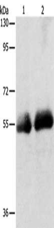 SLC5A5 Antibody