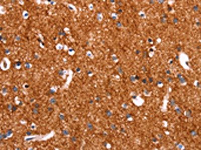 SLC6A1 antibody