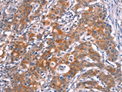 SLC6A1 Antibody