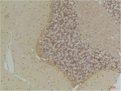 SLC6A1 Antibody