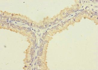 SLC6A15 antibody