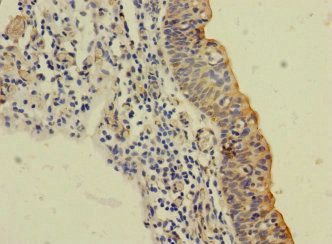 SLC6A15 Antibody
