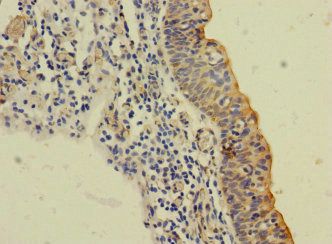 SLC6A15 antibody