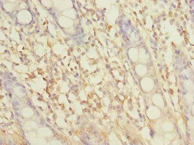 SLC6A16 Antibody
