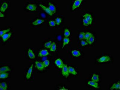 SLC6A3 Antibody