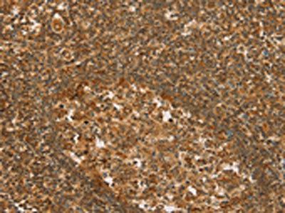 SLC6A3 Antibody